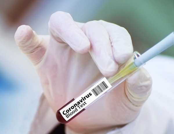 Где в Ленобласти больше зараженных коронавирусом 