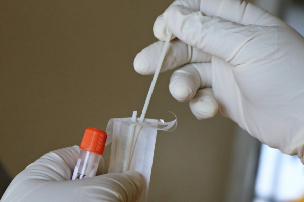 В Ленобласти проверяют первые случаи заражения холерой