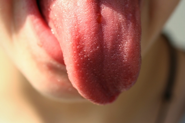 Эксперт рассказал, почему нельзя счищать налет с языка