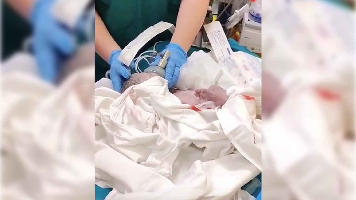 Петербургские врачи спасли пострадавшую в ДТП беременную женщину