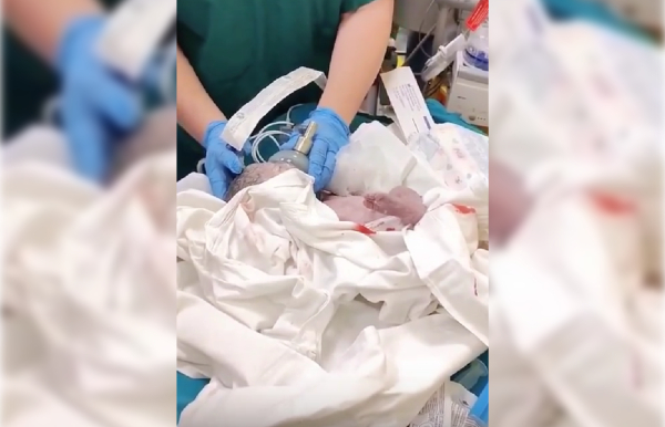 Петербургские врачи спасли пострадавшую в ДТП беременную женщину